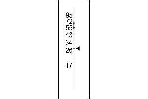 Western blot analysis of SNAI1 Antibody (N-term R8) (ABIN388810 and ABIN2839128) in NCI- cell line lysates (35 μg/lane). (SNAIL Antikörper  (N-Term))