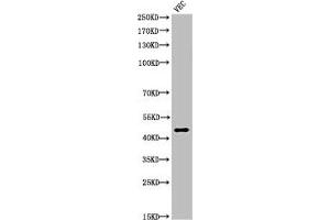 Western Blot analysis of VEC cells using Cleaved-Plasma Kallikrein HC (R390) Polyclonal Antibody (KLKB1 Antikörper  (Cleaved-Arg390))