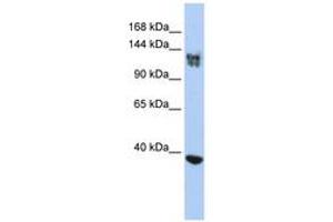 Image no. 1 for anti-SWI/SNF Related, Matrix Associated, Actin Dependent Regulator of Chromatin, Subfamily A, Member 1 (SMARCA1) (AA 35-84) antibody (ABIN6742480) (SMARCA1 Antikörper  (AA 35-84))