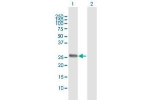 Western Blot analysis of TSSK3 expression in transfected 293T cell line by TSSK3 MaxPab polyclonal antibody. (TSSK3 Antikörper  (AA 1-268))