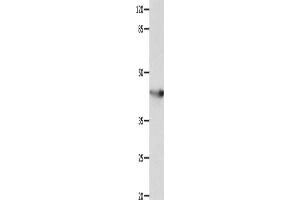 Western Blotting (WB) image for anti-Potassium Voltage-Gated Channel, Shaker-Related Subfamily, Member 5 (KCNA5) antibody (ABIN2428319)