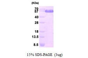 DLD Protein (AA 36-509) (His tag)