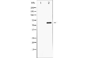 Western blot analysis of CDC25C phosphorylation expression in serum treated HuvEc whole cell lysates,The lane on the left is treated with the antigen-specific peptide.