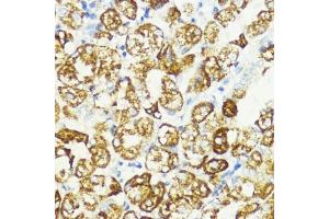 Immunohistochemistry of paraffin-embedded human stomach using S1/PR antibody (ABIN6129890, ABIN6136741, ABIN6136742 and ABIN6221835) at dilution of 1:200 (40x lens). (PRAS40 Antikörper  (AA 152-276))