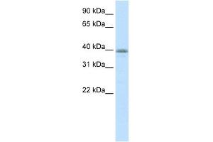 WB Suggested Anti-NEUROD6 Antibody Titration:  0.