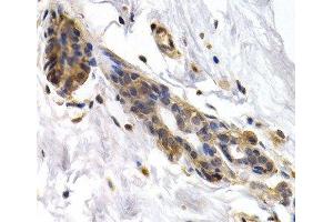 Immunohistochemistry of paraffin-embedded Human normal breast using PKLR Polyclonal Antibody at dilution of 1:200 (40x lens). (PKLR Antikörper)