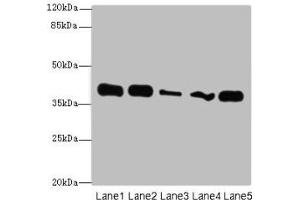 Western blot All lanes: KHDRBS2 antibody at 7 μg/mL Lane 1: K562 whole cell lysate Lane 2: Hela whole cell lysate Lane 3: A431 whole cell lysate Lane 4: Jurkat whole cell lysate Lane 5: NIH/3T3 whole cell lysate Secondary Goat polyclonal to rabbit IgG at 1/10000 dilution Predicted band size: 39 kDa Observed band size: 39 kDa (KHDRBS2 Antikörper  (AA 1-349))