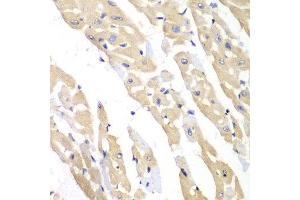 Immunohistochemistry of paraffin-embedded mouse heart using CCT3 antibody at dilution of 1:100 (x40 lens). (CCT3 Antikörper)