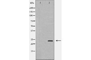 Western blot analysis of Hela whole cell lysates, using RAB11A  Antibody. (RAB11A Antikörper  (C-Term))