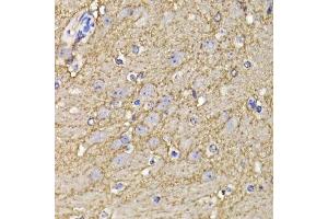 Immunohistochemistry of paraffin-embedded mouse brain using KCND3 antibody. (KCND3 Antikörper  (AA 502-636))