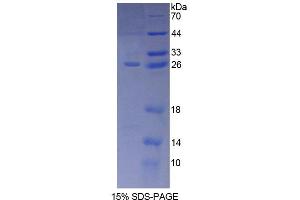 SDS-PAGE analysis of Human SNAP23 Protein.