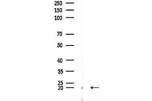 anti-LIM Domain Only 3 (Rhombotin-Like 2) (LMO3) (C-Term) antibody