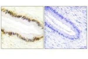 Immunohistochemistry (IHC) image for anti-Nuclear Receptor Subfamily 2, Group F, Member 6 (NR2F6) (N-Term) antibody (ABIN7184487)