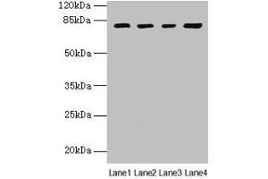 Western blot All lanes: DHX35 antibody at 12 μg/mL Lane 1: Mouse kidney tissue Lane 2: Mouse liver tissue Lane 3: K562 whole cell lysate Lane 4: Hela whole cell lysate Secondary Goat polyclonal to rabbit IgG at 1/10000 dilution Predicted band size: 79, 76 kDa Observed band size: 79 kDa (DHX35 Antikörper  (AA 1-300))