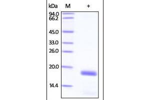 Human Stathmin 1, His Tag on SDS-PAGE under reducing (R) condition. (Stathmin 1 Protein (STMN1) (AA 2-149) (His tag))
