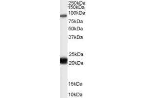 Western Blotting (WB) image for anti-RAS Protein Activator Like 1 (GAP1 Like) (RASAL1) (AA 794-806) antibody (ABIN292170)