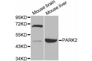 Western blot analysis of extracts of various cell lines, using PARK2 antibody (ABIN5998454) at 1/1000 dilution. (Parkin Antikörper)