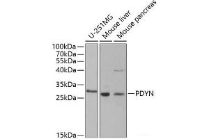 Western blot analysis of extracts of various cell lines using PDYN Polyclonal Antibody at dilution of 1:1000. (PDYN Antikörper)