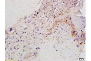 Formalin-fixed and paraffin embedded human placenta labeled with Rabbit Anti CYP19/CYP19A1 Polyclonal Antibody, Unconjugated (ABIN674529) at 1:200 followed by conjugation to the secondary antibody and DAB staining (Aromatase Antikörper  (AA 41-140))