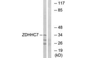 Western Blotting (WB) image for anti-Zinc Finger, DHHC-Type Containing 7 (ZDHHC7) (AA 259-308) antibody (ABIN2890485) (ZDHHC7 Antikörper  (AA 259-308))