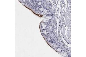 Immunohistochemical staining of human bronchus with C1orf114 polyclonal antibody  shows strong membranous positivity in respiratory epithelial cells. (C1orf114 Antikörper)