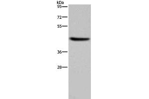 Western Blot analysis of Human adrenal gland tissue using HSD3B1 Polyclonal Antibody at dilution of 1:250 (HSD3B1 Antikörper)