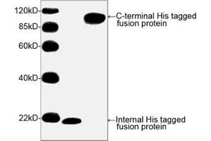 Image no. 2 for anti-His Tag (C-Term) antibody (ABIN294958) (His Tag Antikörper  (C-Term))