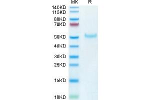 Cynomolgus PVRIG on Tris-Bis PAGE under reduced condition. (PVRIG Protein (AA 41-171) (Fc Tag))