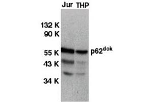 Western Blotting (WB) image for anti-Docking Protein 1, 62kDa (Downstream of tyrosine Kinase 1) (DOK1) (C-Term) antibody (ABIN1030364) (DOK1 Antikörper  (C-Term))