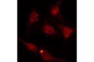 ABIN6277732 staining  HuvEc cells by IF/ICC. (NRF2 Antikörper  (pSer40))