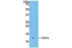 Detection of Recombinant CGa, Human using Polyclonal Antibody to Chorionic Gonadotropin Alpha Polypeptide (CGa) (CGA Antikörper  (AA 25-116))