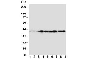 Western blot testing of CrkL antibody and rat samples 1: spleen (CrkL Antikörper  (AA 286-303))