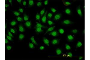 Immunofluorescence of monoclonal antibody to GMEB1 on HeLa cell. (GMEB1 Antikörper  (AA 467-563))