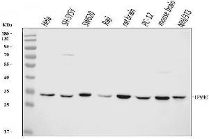 Western blot analysis of YWHAE using anti-YWHAE antibody (ABIN7599165).