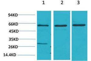 Western Blotting (WB) image for anti-V-Akt Murine Thymoma Viral Oncogene Homolog 2 (AKT2) antibody (ABIN3181588) (AKT2 Antikörper)