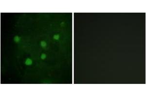 Immunofluorescence analysis of HuvEc cells, using BAF250B Antibody. (ARID1B Antikörper  (AA 1371-1420))