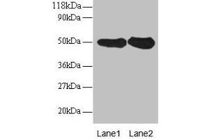 Western blot All lanes: RPN1 antibody at 2 μg/mL Lane 1: EC109 whole cell lysate Lane 2: 293T whole cell lysate Secondary Goat polyclonal to rabbit IgG at 1/15000 dilution Predicted band size: 50 kDa Observed band size: 50 kDa (RPN1 Antikörper  (AA 44-427))