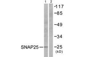 Western blot analysis of extracts from Raw264. (SNAP25 Antikörper  (AA 151-200))