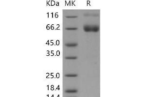 Western Blotting (WB) image for Interferon gamma Receptor 1 (IFNGR1) (Active) protein (Fc Tag) (ABIN7196272)