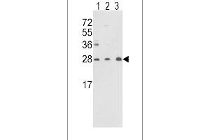 Western blot analysis of TPI1 Antibody (N-term) (ABIN389457 and ABIN2839524) in Y79(lane 1),CEM(lane 2) cell line and mouse brain tissue(lane 3) lysates (35 μg/lane). (TPI1 Antikörper  (N-Term))