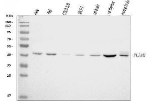 Western blot analysis of UPA Receptor/U-PAR/PLAUR using anti-UPA Receptor/U-PAR/PLAUR antibody (ABIN7599902).