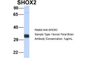 Host: Rabbit Target Name: SHOX2 Sample Type: Human Fetal Brain Antibody Dilution: 1. (SHOX2 Antikörper  (N-Term))