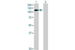 Lane 1: EXO1 transfected lysate ( 93. (EXO1 293T Cell Transient Overexpression Lysate(Denatured))