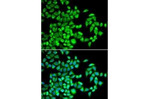 Immunofluorescence analysis of U2OS cells using  antibody (ABIN6131447, ABIN6136794, ABIN6136796 and ABIN6218313). (ALKBH1 Antikörper  (AA 110-389))