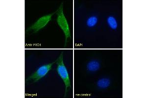 ABIN185667 Immunofluorescence analysis of paraformaldehyde fixed NIH3T3 cells, permeabilized with 0. (Patched 1 Antikörper  (Internal Region))