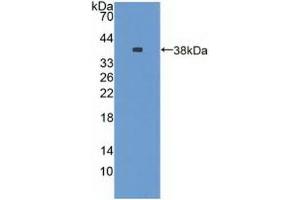 Detection of Recombinant NES, Rat using Polyclonal Antibody to Nestin (NES) (Nestin Antikörper  (AA 197-462))