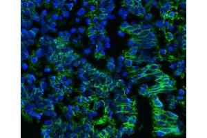 IF analysis of CD147/Emmprin using anti-CD147/Emmprin antibody (ABIN7599999). (CD147 Antikörper  (AA 138-323))