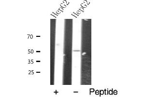 Western blot analysis of extracts from HepG2 cells, using VIPR2 antibody. (VIPR2 Antikörper  (Internal Region))