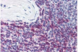 Human Spleen (formalin-fixed, paraffin-embedded) stained with CD7 antibody ABIN298827 at 5 ug/ml followed by biotinylated anti-mouse IgG secondary antibody ABIN481714, alkaline phosphatase-streptavidin and chromogen. (CD7 Antikörper)