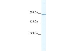 WB Suggested Anti-KLHL5 Antibody Titration:  5. (KLHL5 Antikörper  (N-Term))